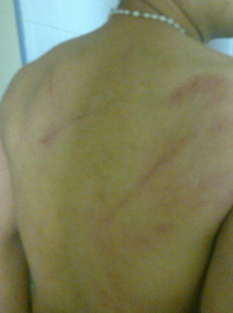 Denunciaron que la Policía los maltrató y los golpeó